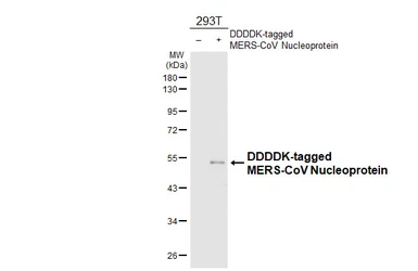 Anti-MERS-CoV Nucleoprotein antibody [HL6818] used in Western Blot (WB). GTX649632