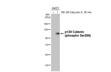 Anti-p120 Catenin (phospho Ser268) antibody [HL6869] used in Western Blot (WB). GTX649713