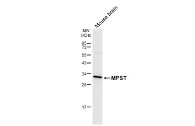 Anti-MPST antibody [HL6870] used in Western Blot (WB). GTX649714