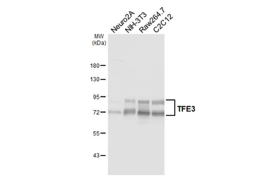 Anti-TFE3 antibody [HL6873] used in Western Blot (WB). GTX649717