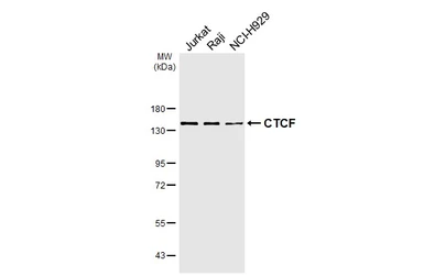 Anti-CTCF antibody [HL6877] used in Western Blot (WB). GTX649721