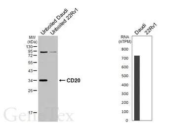 Anti-CD20 antibody [GT451] used in Western Blot (WB). GTX649727