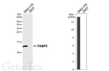 Anti-FABP2 antibody [HL6897] used in Western Blot (WB). GTX649749