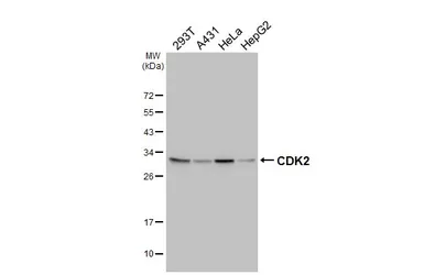 Anti-CDK2 antibody [HL6918] used in Western Blot (WB). GTX649770