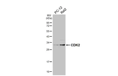 Anti-CDK2 antibody [HL6918] used in Western Blot (WB). GTX649770