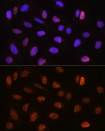 Anti-CSTF2T antibody used in Immunocytochemistry/ Immunofluorescence (ICC/IF). GTX64989