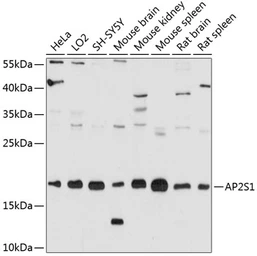 Anti-AP2S1 antibody used in Western Blot (WB). GTX65527