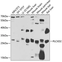 Anti-PLCXD2 antibody used in Western Blot (WB). GTX65534