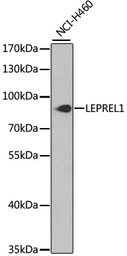 Anti-LEPREL1 antibody used in Western Blot (WB). GTX65537