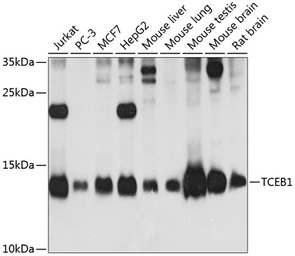 Anti-TCEB1 antibody used in Western Blot (WB). GTX65573