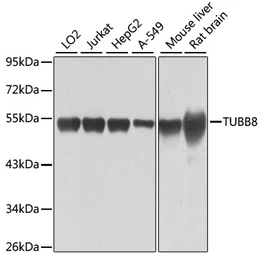 Anti-beta Tubulin 8 antibody used in Western Blot (WB). GTX65574