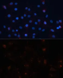 Anti-UBL3 antibody used in Immunocytochemistry/ Immunofluorescence (ICC/IF). GTX65591