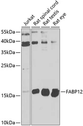 Anti-FABP12 antibody used in Western Blot (WB). GTX65608