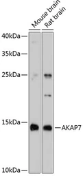 Anti-AKAP7 antibody used in Western Blot (WB). GTX65620