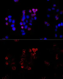 Anti-ABCG8 antibody used in Immunocytochemistry/ Immunofluorescence (ICC/IF). GTX65624