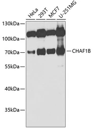 Anti-CHAF1B antibody used in Western Blot (WB). GTX65808
