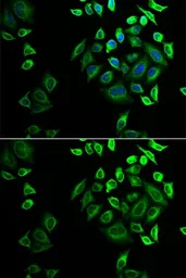 Anti-PLA2G2D antibody used in Immunocytochemistry/ Immunofluorescence (ICC/IF). GTX65810