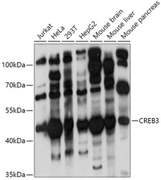 Anti-LZIP antibody used in Western Blot (WB). GTX65817