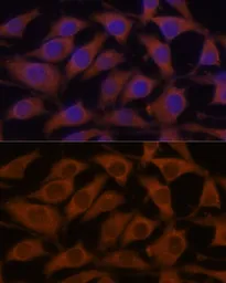 Anti-LZIP antibody used in Immunocytochemistry/ Immunofluorescence (ICC/IF). GTX65817