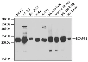 Anti-BCAP31 antibody used in Western Blot (WB). GTX65823