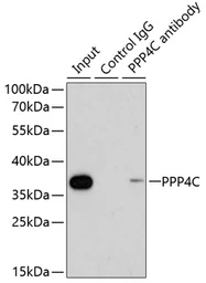 Anti-PPP4C antibody used in Immunoprecipitation (IP). GTX65836