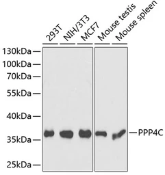 Anti-PPP4C antibody used in Western Blot (WB). GTX65836