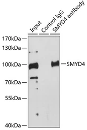 Anti-SMYD4 antibody used in Immunoprecipitation (IP). GTX65838