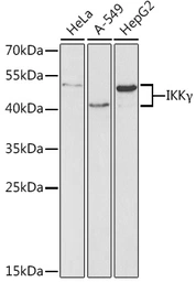 Anti-IKK gamma antibody used in Western Blot (WB). GTX65841