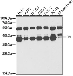 Anti-Fibrillarin antibody used in Western Blot (WB). GTX65859