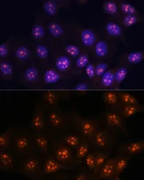 Anti-Fibrillarin antibody used in Immunocytochemistry/ Immunofluorescence (ICC/IF). GTX65859