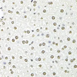Anti-Fibrillarin antibody used in IHC (Paraffin sections) (IHC-P). GTX65859