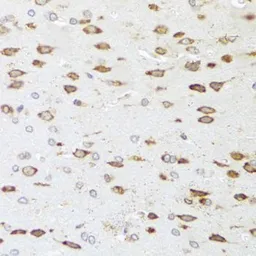 Anti-p190-B RhoGAP antibody used in IHC (Paraffin sections) (IHC-P). GTX65862
