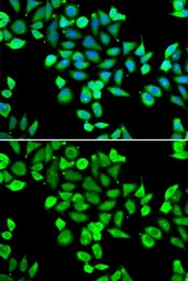 Anti-Apc6 antibody used in Immunocytochemistry/ Immunofluorescence (ICC/IF). GTX65871