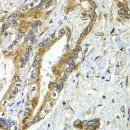Anti-Apc6 antibody used in IHC (Paraffin sections) (IHC-P). GTX65871