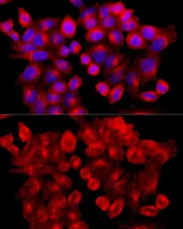 Anti-Clathrin Heavy chain antibody used in Immunocytochemistry/ Immunofluorescence (ICC/IF). GTX65878