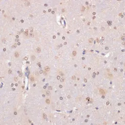 Anti-LRDD antibody used in IHC (Paraffin sections) (IHC-P). GTX65888