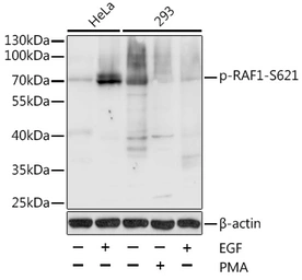 Anti-Raf1 (phospho Ser621) antibody used in Western Blot (WB). GTX65906