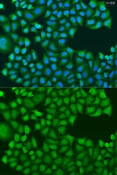 Anti-TIRAP antibody used in Immunocytochemistry/ Immunofluorescence (ICC/IF). GTX65910