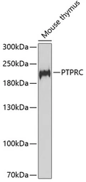Anti-CD45 antibody used in Western Blot (WB). GTX65913