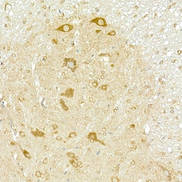 Anti-COPB2 antibody used in IHC (Paraffin sections) (IHC-P). GTX65917