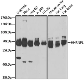Anti-hnRNP L antibody used in Western Blot (WB). GTX65923