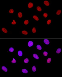 Anti-CTCF antibody used in Immunocytochemistry/ Immunofluorescence (ICC/IF). GTX65926