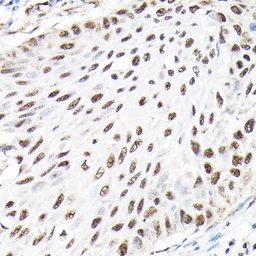 Anti-CTCF antibody used in IHC (Paraffin sections) (IHC-P). GTX65926