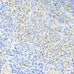 Anti-CTCF antibody used in IHC (Paraffin sections) (IHC-P). GTX65930