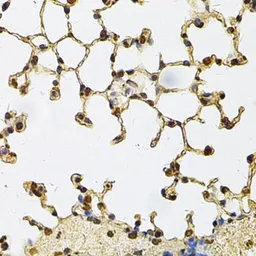 Anti-IFI16 antibody used in IHC (Paraffin sections) (IHC-P). GTX65937