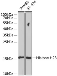Anti-HIST2H2BE antibody used in Western Blot (WB). GTX65940