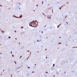 Anti-Prokineticin 2 antibody used in IHC (Paraffin sections) (IHC-P). GTX65949