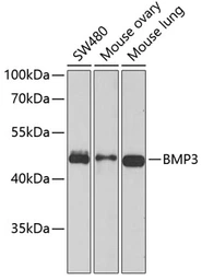 Anti-BMP3 antibody used in Western Blot (WB). GTX65951