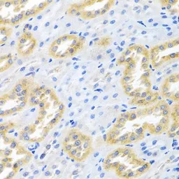 Anti-BMP3 antibody used in IHC (Paraffin sections) (IHC-P). GTX65951