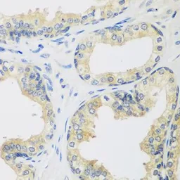 Anti-Rent2 antibody used in IHC (Paraffin sections) (IHC-P). GTX65954